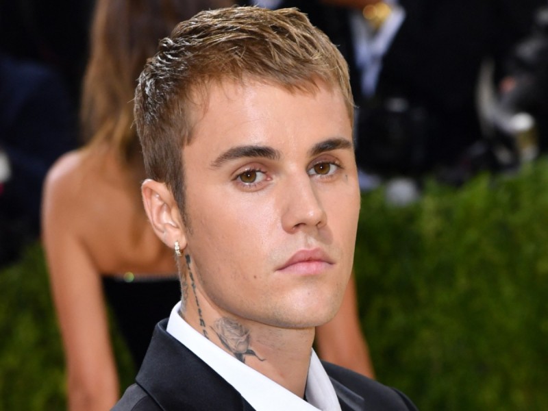 Justin Bieber informa que tiene parálisis facial y pospone conciertos; «este ojo no parpadea»